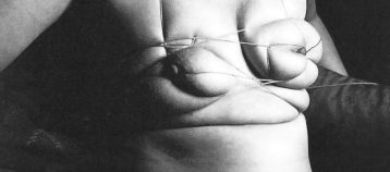 Unica Zürn, fotografiada por Hans Bellmer, 1958.